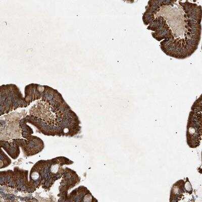 Immunohistochemistry-Paraffin: MTCH1 Antibody [NBP1-84505]