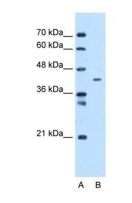 Western Blot: MTCH1 Antibody [NBP1-69285]