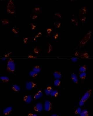 Immunocytochemistry/ Immunofluorescence: MTCH2 Antibody - Azide and BSA Free [NBP2-94185]