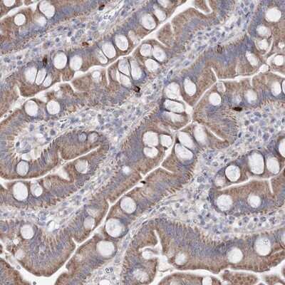 Immunohistochemistry-Paraffin: MTCH2 Antibody [NBP1-89482]