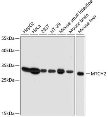 Western Blot: MTCH2 AntibodyAzide and BSA Free [NBP2-94185]