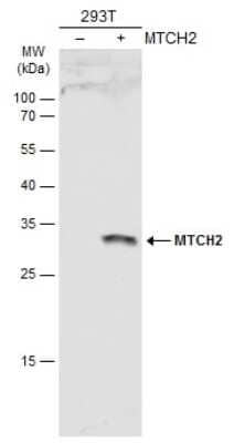 Western Blot: MTCH2 Antibody [NBP3-12914]