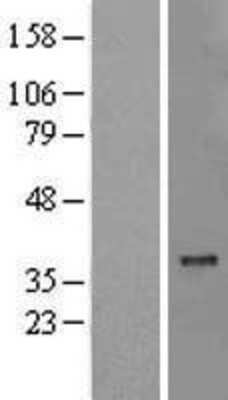 Western Blot: MTCH2 Overexpression Lysate [NBL1-13354]