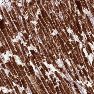 Immunohistochemistry: MTCO1 Antibody [NBP2-49596]