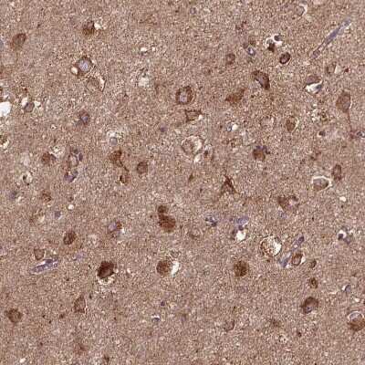 Immunohistochemistry-Paraffin: MTCO1 Antibody [NBP2-49596]