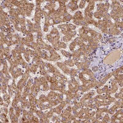 Immunohistochemistry-Paraffin: MTCO1 Antibody [NBP2-49596]