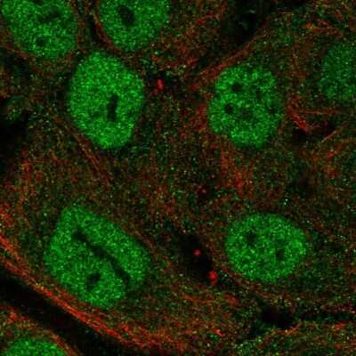 Immunocytochemistry/ Immunofluorescence: MTCP1 Antibody [NBP2-58455]