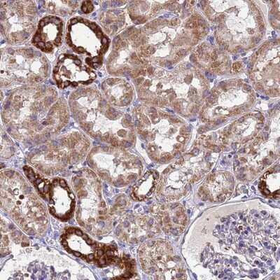 Immunohistochemistry-Paraffin: MTCP1NB Antibody [NBP1-93450]