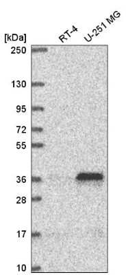 Western Blot: MTERF Antibody [NBP2-57353]