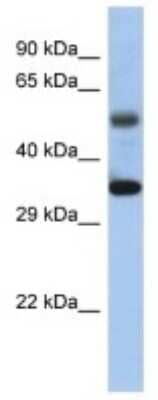 Western Blot: MTERF Antibody [NBP3-10303]