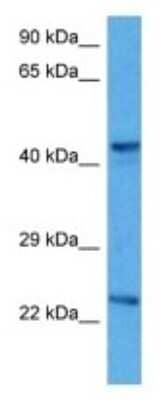 Western Blot: MTERF Antibody [NBP3-10991]