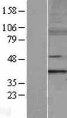 Western Blot: MTERF Overexpression Lysate [NBL1-13356]