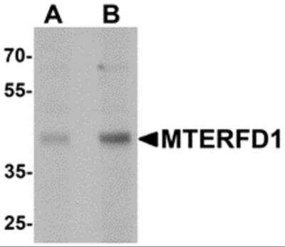 Western Blot: MTERFD1 AntibodyBSA Free [NBP2-81740]