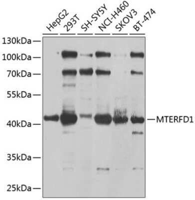 Western Blot: MTERFD1 AntibodyBSA Free [NBP2-93317]