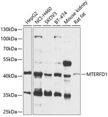 Western Blot: MTERFD1 AntibodyBSA Free [NBP2-95134]