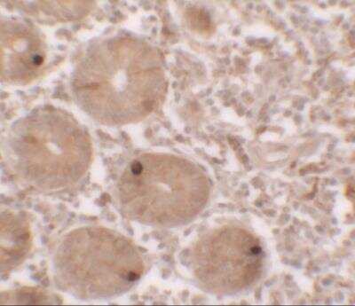 Immunohistochemistry: MTERFD2 Antibody - BSA Free [NBP2-81966]