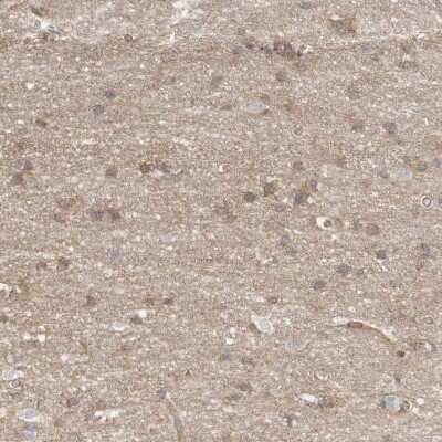 Immunohistochemistry-Paraffin: MTERFD2 Antibody [NBP1-81055]