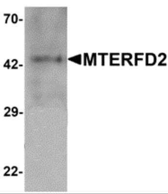 Western Blot: MTERFD2 AntibodyBSA Free [NBP2-81966]