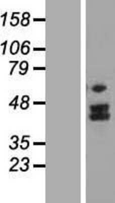 Western Blot: MTERFD2 Overexpression Lysate [NBL1-13358]