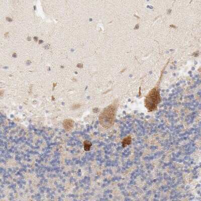 Immunohistochemistry-Paraffin: MTERFD3 Antibody [NBP1-82241]