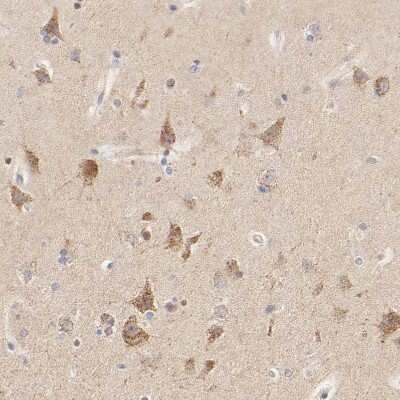 Immunohistochemistry-Paraffin: MTERFD3 Antibody [NBP1-82241]