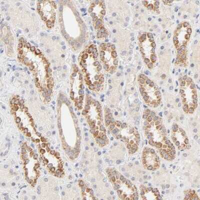 Immunohistochemistry-Paraffin: MTERFD3 Antibody [NBP1-82241]