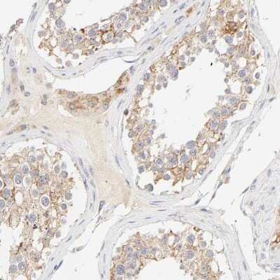 Immunohistochemistry-Paraffin: MTERFD3 Antibody [NBP1-82241]