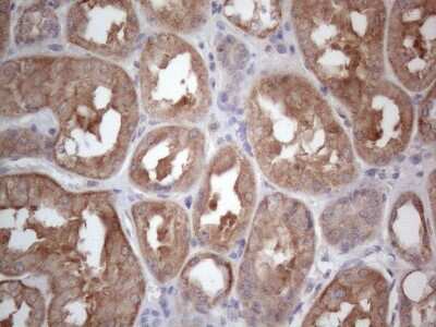Immunohistochemistry: MTF1 Antibody (OTI2F3) [NBP2-46027]