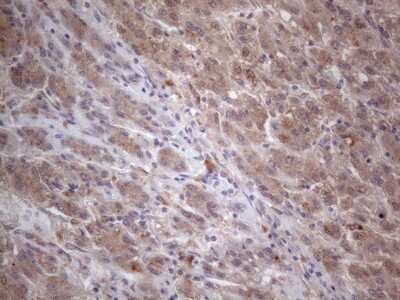 Immunohistochemistry: MTF1 Antibody (OTI2F3) [NBP2-46027]