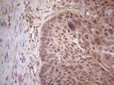Immunohistochemistry: MTF1 Antibody (OTI2F3) [NBP2-46027]