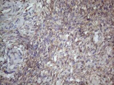 Immunohistochemistry: MTF1 Antibody (OTI2F3) [NBP2-46027]