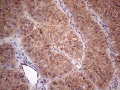 Immunohistochemistry: MTF1 Antibody (OTI2F3) [NBP2-46027]