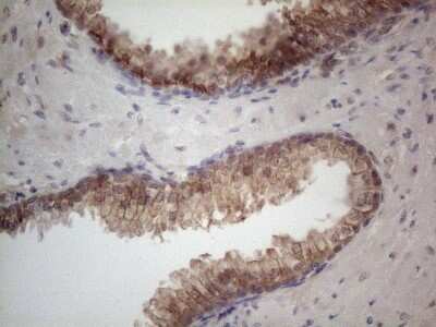 Immunohistochemistry: MTF1 Antibody (OTI2F3) [NBP2-46027]