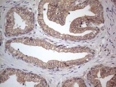 Immunohistochemistry: MTF1 Antibody (OTI2F3) [NBP2-46027]