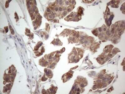 Immunohistochemistry: MTF1 Antibody (OTI2F3) [NBP2-46027]