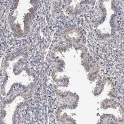 Immunohistochemistry-Paraffin: MTF1 Antibody [NBP1-86379]
