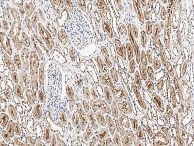 Immunohistochemistry-Paraffin: MTF1 Antibody [NBP3-12562]