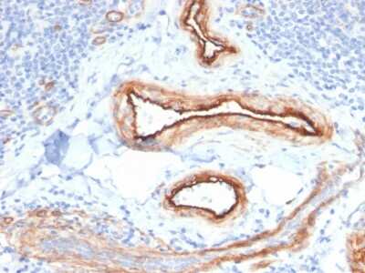 Immunohistochemistry-Paraffin: MTF1 Antibody (MTF1/2649) - Azide and BSA Free [NBP3-08238]