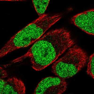 Immunocytochemistry/ Immunofluorescence: MTF2 Antibody [NBP2-56629]