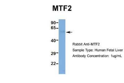 Western Blot: MTF2 Antibody [NBP1-97438]