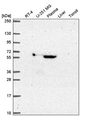 Western Blot: MTF2 Antibody [NBP2-55885]