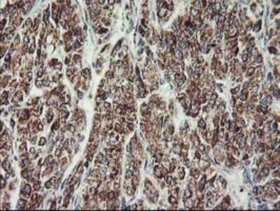 Immunohistochemistry-Paraffin: MTFMT Antibody (OTI1E7) [NBP2-01232]