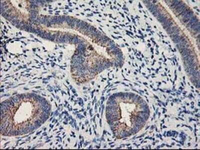 Immunohistochemistry-Paraffin: MTFMT Antibody (OTI1E7) [NBP2-01232]