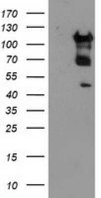 Western Blot: MTFMT Antibody (OTI1E7) [NBP2-01232]