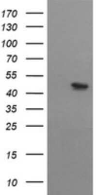 Western Blot: MTFMT Antibody (OTI2A2) [NBP2-46028]