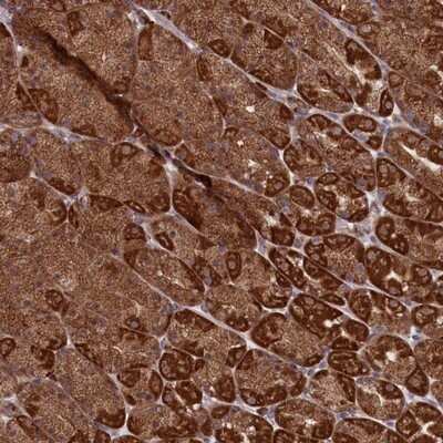 Immunohistochemistry-Paraffin: MTFMT Antibody [NBP1-81871]