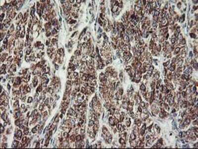 Immunohistochemistry: MTFMT Antibody (OTI1E7) - Azide and BSA Free [NBP2-72801]