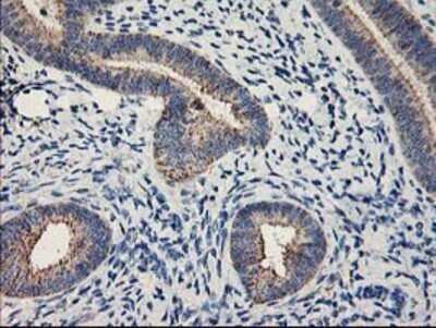 Immunohistochemistry: MTFMT Antibody (OTI1E7) - Azide and BSA Free [NBP2-72801]