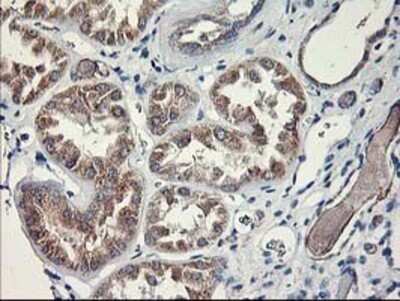 Immunohistochemistry: MTFMT Antibody (OTI1E7) - Azide and BSA Free [NBP2-72801]