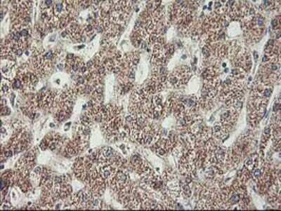Immunohistochemistry: MTFMT Antibody (OTI1E7) - Azide and BSA Free [NBP2-72801]